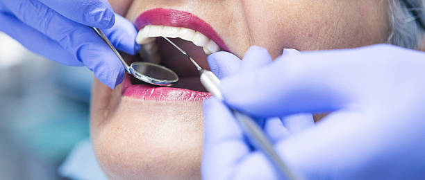 Best Emergency Dental Care for Abscessed Tooth in Dunkirk, NY